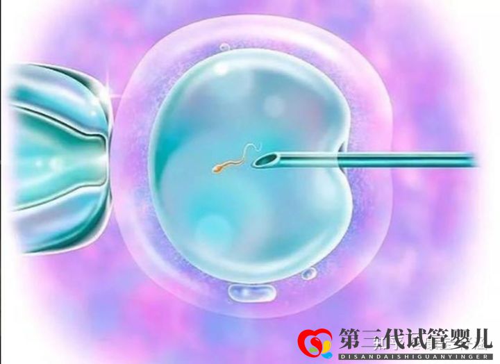 通俗易懂的一、二、三代試管嬰兒解說,及三代試管能...(圖4)