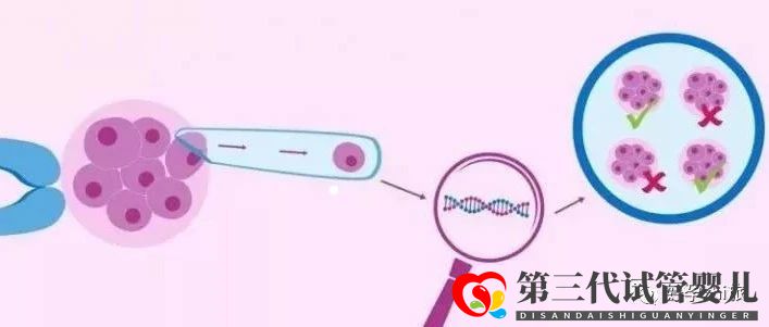 通俗易懂的一、二、三代試管嬰兒解說,及三代試管能...(圖7)