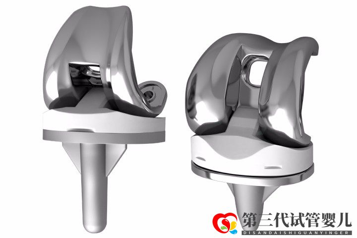 人工膝關(guān)節(jié)置換手術(shù)成功率大嗎？膝關(guān)節(jié)置換手術(shù)成功率有多高？(圖1)