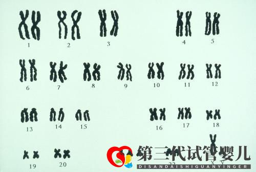夫妻染色體正常，試管胚胎染色體異常的三個原因你都知道嗎？(圖1)
