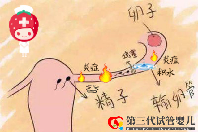 報(bào)喜萬(wàn)家！輸卵管積水的她放棄做試管，卻憑一劑中藥喜獲“好孕”(圖1)