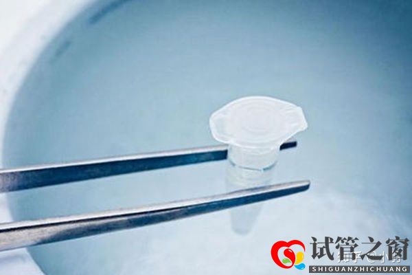 一文帶你了解試管嬰兒整個流程個各個環(huán)節(jié)時間節(jié)點(diǎn)的...(圖3)