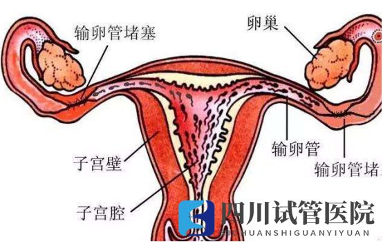 成都兩側輸卵管堵塞想要孩子，聽說試管嬰兒是最好的選擇(圖1)