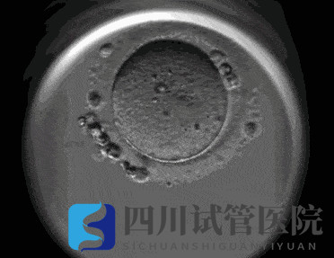 成都試管嬰兒醫(yī)院引進(jìn)“時(shí)差培養(yǎng)箱”，助力篩選更具發(fā)育潛力的胚胎(圖2)
