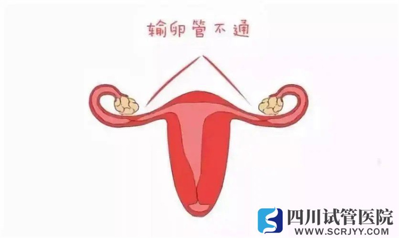 輸卵管的這兩項(xiàng)功能對(duì)懷孕至關(guān)重要，怎么知道它好不好？(圖1)