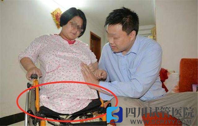 “無腿”媽媽試管生下雙胞胎，如今5年過去，一家人現(xiàn)狀如何？(圖1)