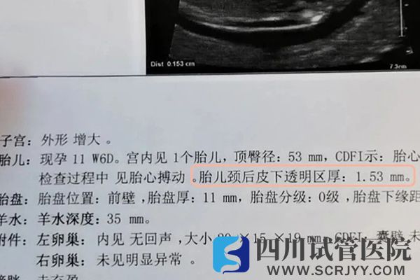 胎兒頸后透明帶增厚表示存在致病風(fēng)險(xiǎn)