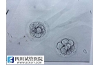 做試管嬰兒一次移植多個(gè)襄胚有好處嗎？
